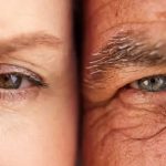 Aging